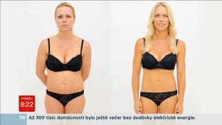 Liposukce urychlí vaše hubnutí