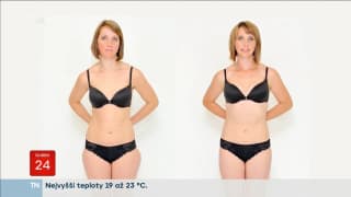 Liposukce - Snídaně s Novou