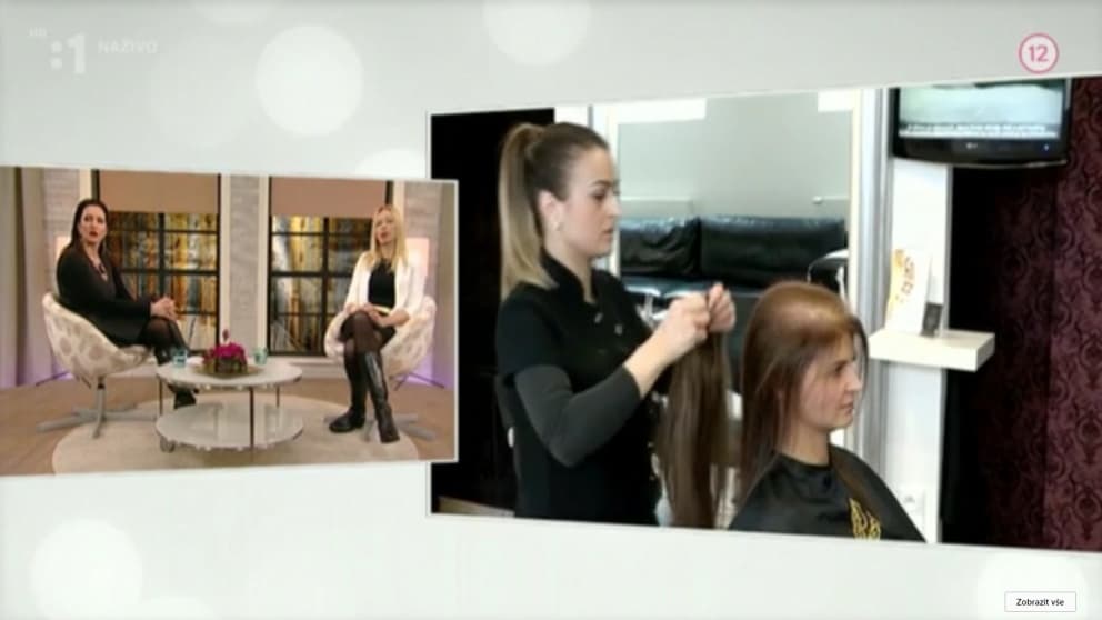Riešenie riedkych vlasov a lyzín - Hairdreams Microlines - Salón YES VIP